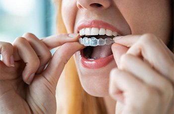 A woman preparing to wear her Invisalign aligners