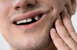 Patient in McAlpine rubbing cheek with missing tooth
