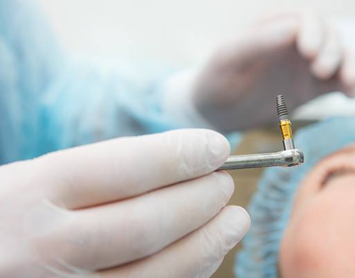 Dental implant surgery